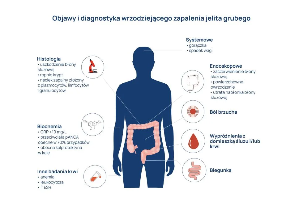 pieluchomajtki dla dorosłych na basen